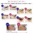 画像6: シワパッチ　（10分で感じるお肌の違い！強力にストレッチ！） (6)